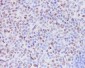 Anti-KMT6 / EZH2 Rabbit Monoclonal Antibody