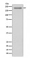 Anti-PDGFR alpha Rabbit Monoclonal Antibody