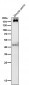 Anti-PDGFR alpha Rabbit Monoclonal Antibody