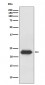 Anti-Lipocalin-2 LCN2 Rabbit Monoclonal Antibody