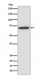 Anti-Perilipin A PLIN1 Rabbit Monoclonal Antibody