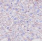 Anti-LDL Receptor Rabbit Monoclonal Antibody