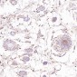 Anti-Cleaved PARP PARP1 Rabbit Monoclonal Antibody