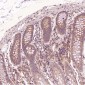 Anti-Cleaved PARP PARP1 Rabbit Monoclonal Antibody