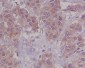 Anti-DAP Kinase 1 DAPK1 Rabbit Monoclonal Antibody