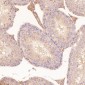 Anti-Calreticulin Rabbit Monoclonal Antibody