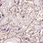 Anti-Calreticulin Rabbit Monoclonal Antibody