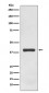 Anti-AMPK gamma 1 Rabbit Monoclonal Antibody