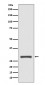 Anti-14-3-3 sigma SFN Rabbit Monoclonal Antibody