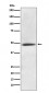 Anti-CaMKII alpha CAMK2A Rabbit Monoclonal Antibody