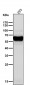 Anti-CaMKII delta CAMK2D Rabbit Monoclonal Antibody