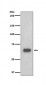 Anti-p70 S6 Kinase RPS6KB1 Rabbit Monoclonal Antibody