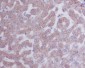 Anti-Cytokeratin 8 KRT8 Rabbit Monoclonal Antibody