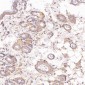 Anti-Cytokeratin 8 KRT8 Rabbit Monoclonal Antibody