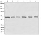 Anti-Tubulin gamma Rabbit Monoclonal Antibody