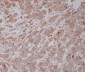 Anti-Tubulin gamma Rabbit Monoclonal Antibody