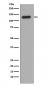 Anti-Collagen XVII Rabbit Monoclonal Antibody