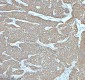 Anti-Cytokeratin 5 KRT5 Rabbit Monoclonal Antibody