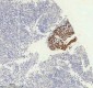 Anti-Cytokeratin 5 KRT5 Rabbit Monoclonal Antibody