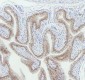 Anti-Cytokeratin 5 KRT5 Rabbit Monoclonal Antibody