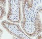 Anti-Cytokeratin 5 KRT5 Rabbit Monoclonal Antibody