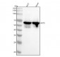 Anti-Cytokeratin 5 KRT5 Rabbit Monoclonal Antibody