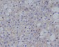 Anti-PD-L1 (CD274) Rabbit Monoclonal Antibody
