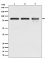 Anti-Catenin gamma JUP Rabbit Monoclonal Antibody