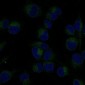 Anti-NF-Kappa B p65 RELA Rabbit Monoclonal Antibody