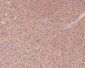 Anti-NF-Kappa B p65 RELA Rabbit Monoclonal Antibody