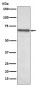 Anti-NF-Kappa B p65 RELA Rabbit Monoclonal Antibody