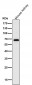 Anti-NF-Kappa B p65 RELA Rabbit Monoclonal Antibody