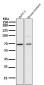 Anti-NF-Kappa B p65 RELA Rabbit Monoclonal Antibody