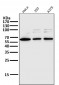 Anti-NF-Kappa B p65 RELA Rabbit Monoclonal Antibody