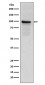 Anti-Thrombomodulin THBD Rabbit Monoclonal Antibody