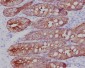 Anti-Cytokeratin 19 KRT19 Rabbit Monoclonal Antibody