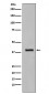 Anti-Cytokeratin 19 KRT19 Rabbit Monoclonal Antibody