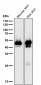 Anti-Cytokeratin 15 Rabbit Monoclonal Antibody