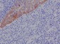 Anti-Cytokeratin 17 Rabbit Monoclonal Antibody