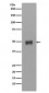 Anti-Cytokeratin 17 Rabbit Monoclonal Antibody