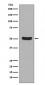 Anti-Cytokeratin 16 KRT16 Rabbit Monoclonal Antibody