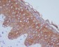 Anti-Cytokeratin 14 KRT14 Rabbit Monoclonal Antibody