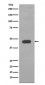 Anti-Cytokeratin 14 KRT14 Rabbit Monoclonal Antibody