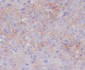 Anti-P Glycoprotein ABCB1 Rabbit Monoclonal Antibody