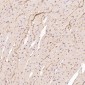 Anti-P Glycoprotein ABCB1 Rabbit Monoclonal Antibody