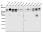 Anti-P Glycoprotein ABCB1 Rabbit Monoclonal Antibody