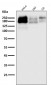 Anti-P Glycoprotein ABCB1 Rabbit Monoclonal Antibody