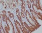 Anti-Cytokeratin 14 KRT14 Rabbit Monoclonal Antibody