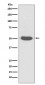 Anti-Cytokeratin 14 KRT14 Rabbit Monoclonal Antibody