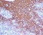 Anti-Cytokeratin 13 Rabbit Monoclonal Antibody